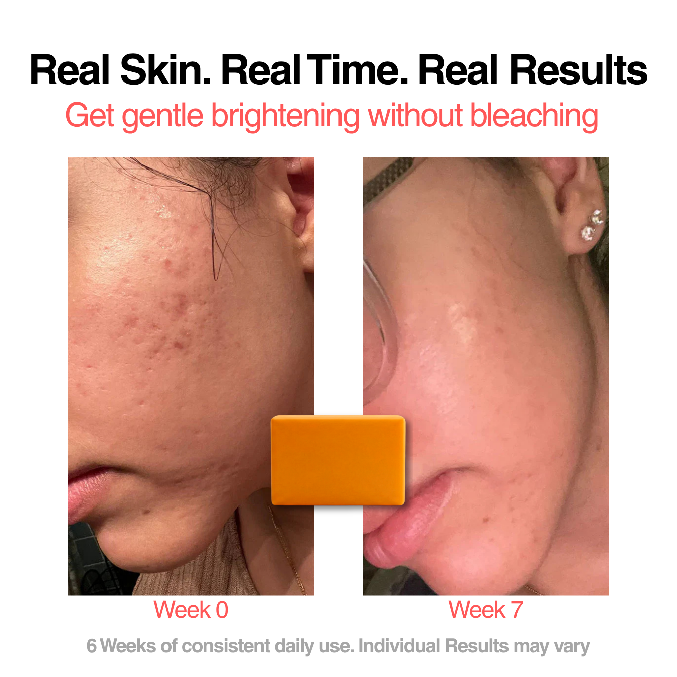 Glowvani Turmeric Kojic Brightening Soap